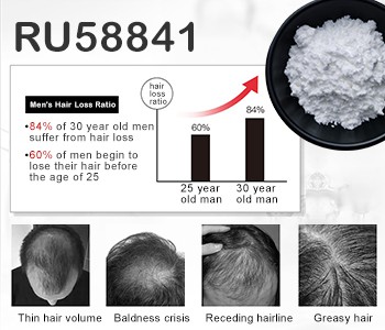 ¿La caída del cabello realmente tiene un gran impacto en la apariencia?