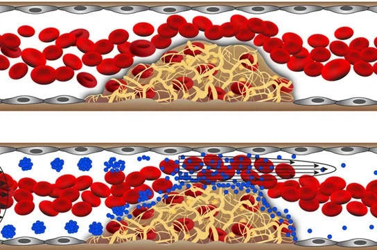 dissolve blood clots
