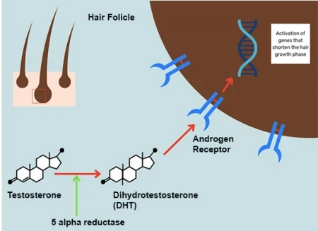 Does pyrilutamide stop hair loss A Does pyrilutamide stop hair loss A
