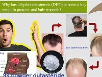 ¿Por qué la DHT se ha convertido en un objetivo clave en la investigación sob...